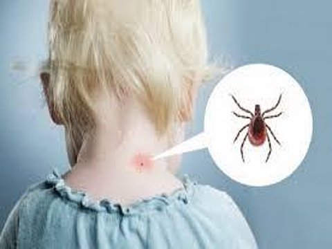 La malattia di Lyme nel bambino