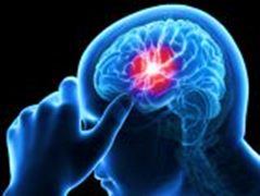 Il legame tra malattia di Lyme e ictus
