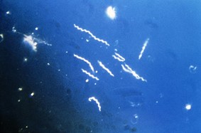 Lyme: biofilm KO?